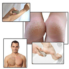 Load image into Gallery viewer, Skinapeel Large Pumice Stone