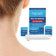 Load image into Gallery viewer, Tagcure - Skin Tag Removal Device