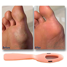 Load image into Gallery viewer, Glamza Professional Pedicure Foot File