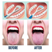 Load image into Gallery viewer, GLAMZA Stainless Steel Tongue Scraper