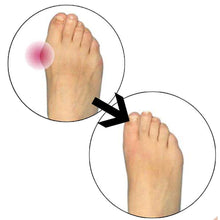 Load image into Gallery viewer, Glamza Splint Corrector Device