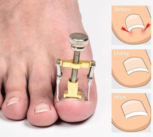 Load image into Gallery viewer, Ingrown Toenail Corrector