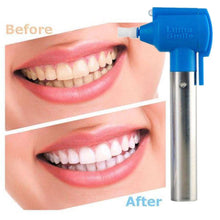 Load image into Gallery viewer, Luma Smile Teeth Whitening Polish Machine