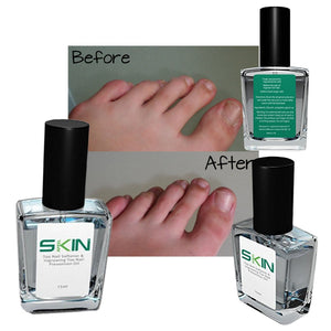 Skinapeel Toe Nail Softener and Ingrowing Toenail Prevention Oil