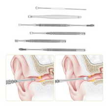 Load image into Gallery viewer, Glamza - 6pc Ear Wax Removal Kit